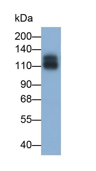 Monoclonal Antibody to Sialic Acid Binding Ig Like Lectin 2 (CD22)