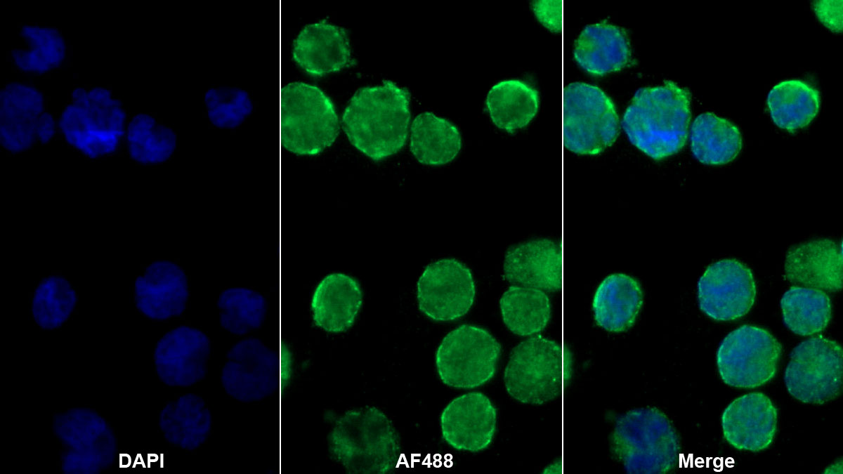 Monoclonal Antibody to Cluster Of Differentiation 4 (CD4)