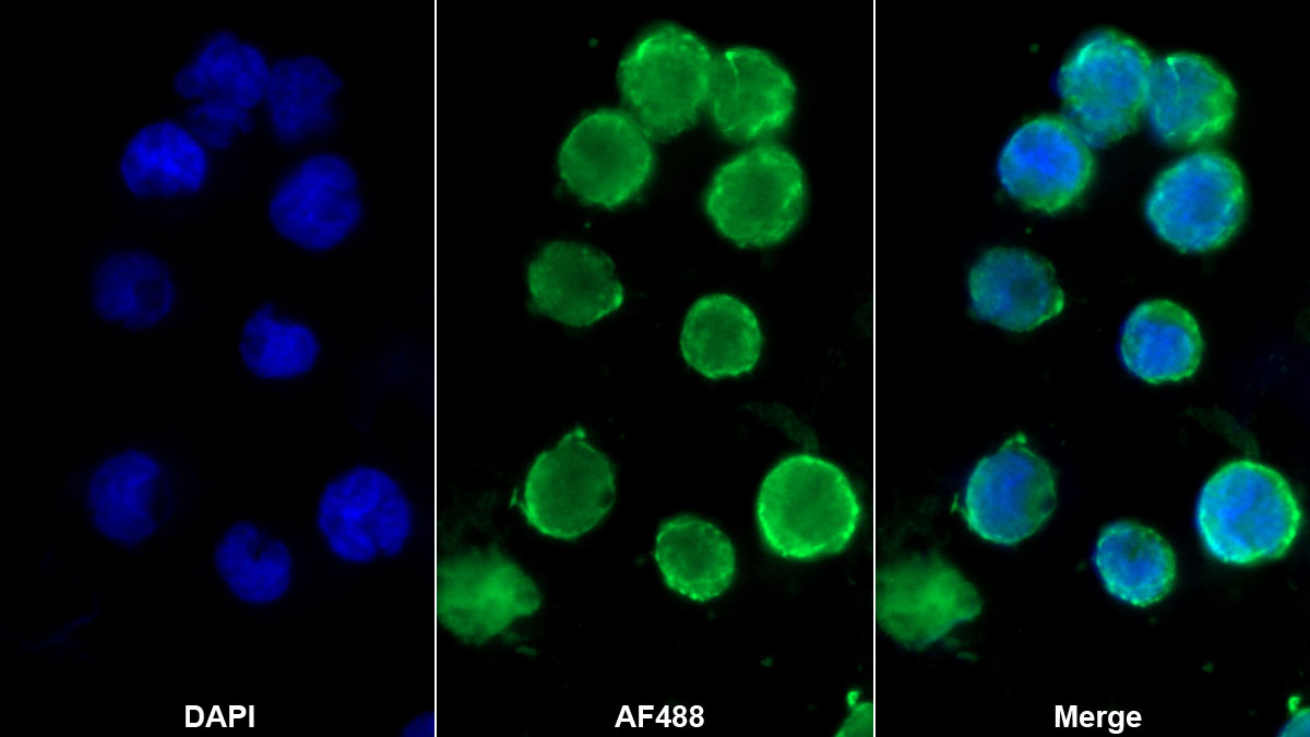 Monoclonal Antibody to Cluster Of Differentiation 4 (CD4)