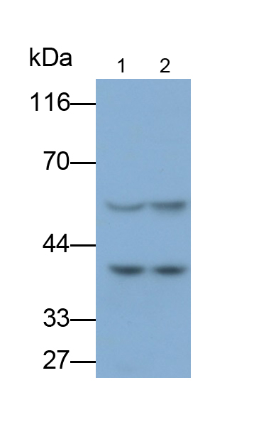 Monoclonal Antibody to Cluster Of Differentiation 4 (CD4)