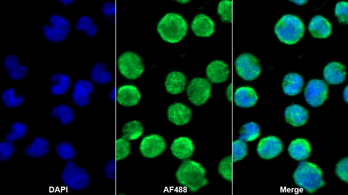 Monoclonal Antibody to Cluster Of Differentiation 4 (CD4)