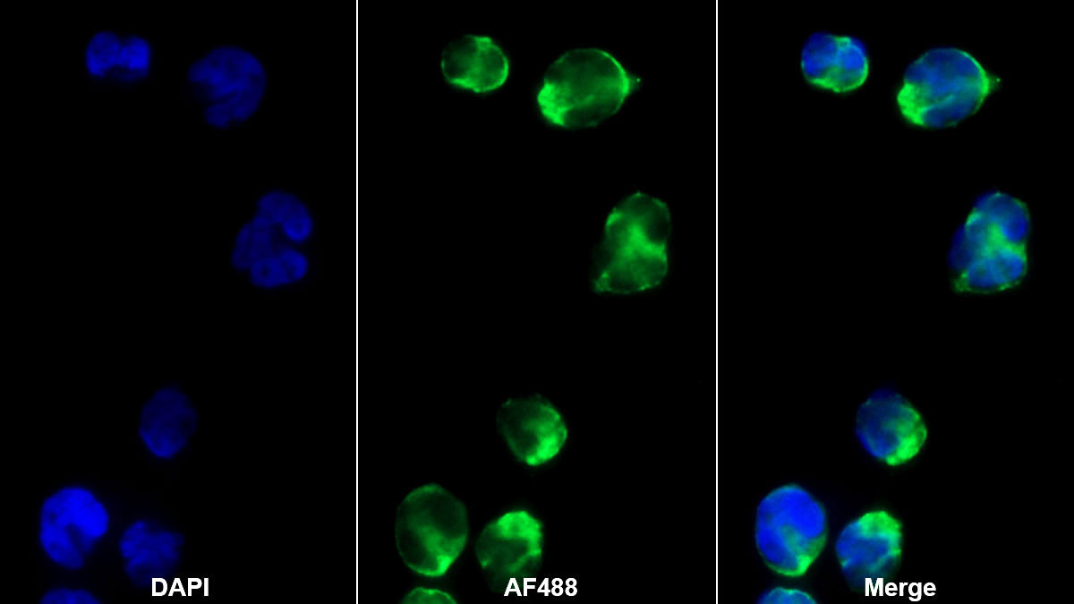 Monoclonal Antibody to Cluster Of Differentiation 4 (CD4)