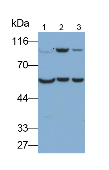 Monoclonal Antibody to Transferrin Receptor (TFR)