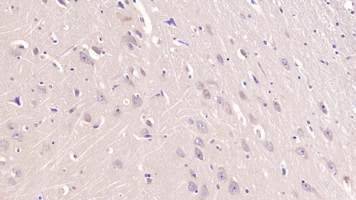 Monoclonal Antibody to Transferrin Receptor (TFR)