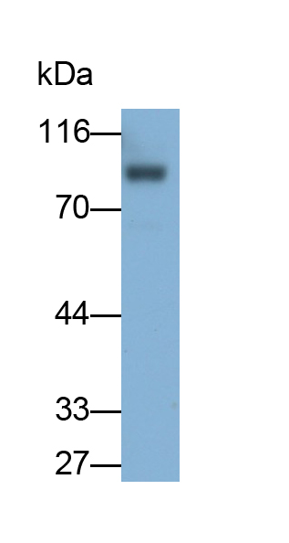 Monoclonal Antibody to Transferrin Receptor (TFR)