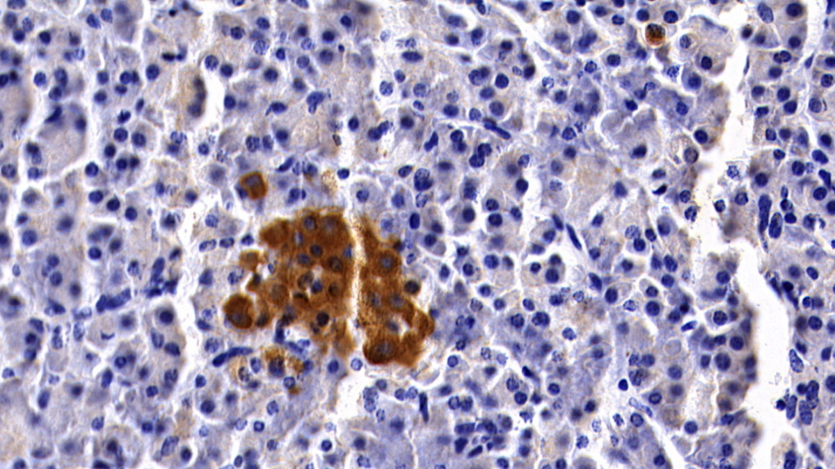 Monoclonal Antibody to Clusterin (CLU)