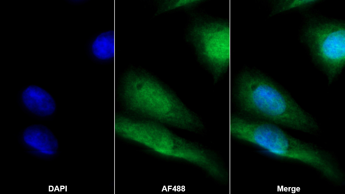 Monoclonal Antibody to Clusterin (CLU)