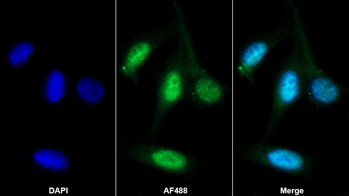 Monoclonal Antibody to Clusterin (CLU)