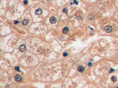 Monoclonal Antibody to Glucose Transporter 1 (GLUT1)