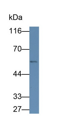 Monoclonal Antibody to Glucose Transporter 1 (GLUT1)