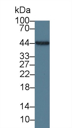 Monoclonal Antibody to Interleukin 19 (IL19)