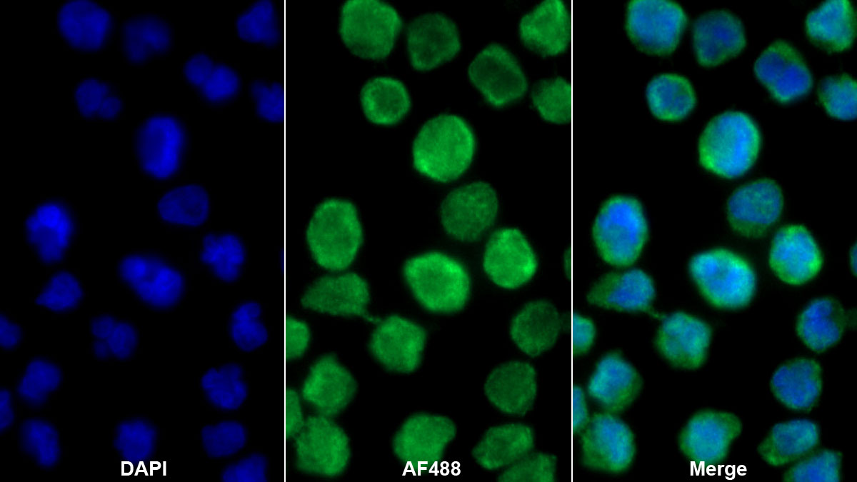 Monoclonal Antibody to Interleukin 19 (IL19)