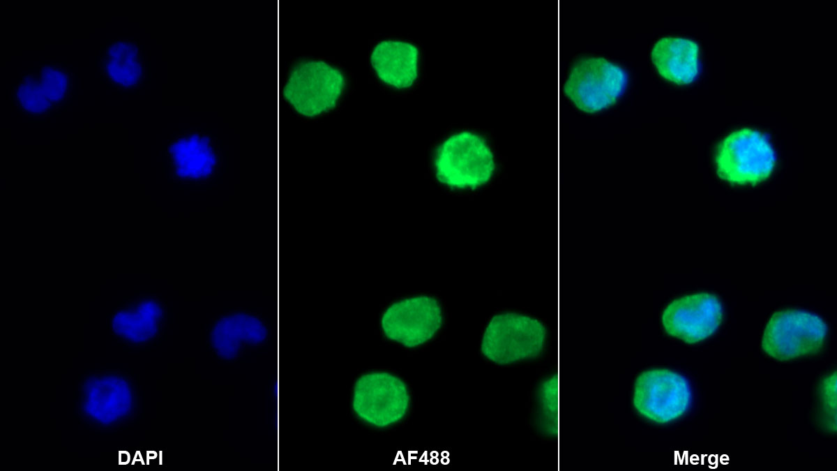 Monoclonal Antibody to Interleukin 19 (IL19)