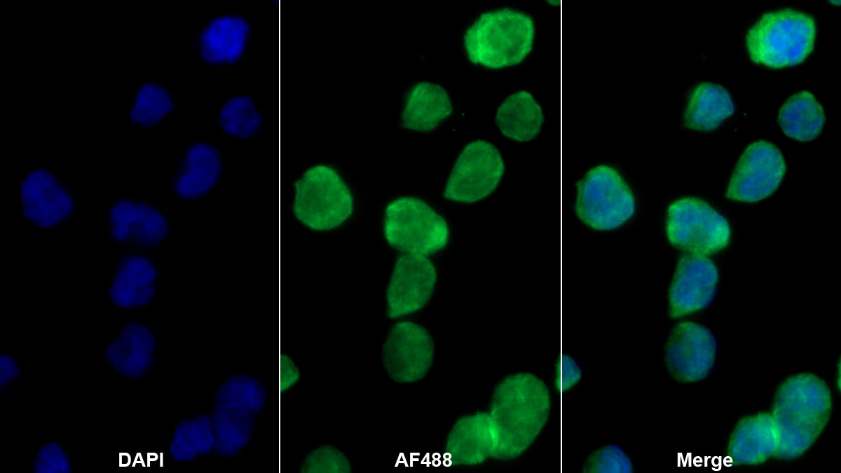 Monoclonal Antibody to Interleukin 19 (IL19)