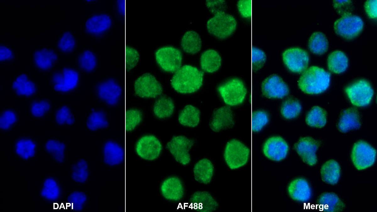 Monoclonal Antibody to Interleukin 19 (IL19)