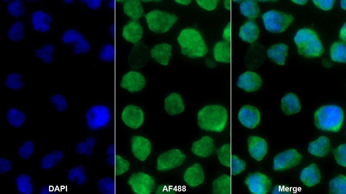 Monoclonal Antibody to Interleukin 19 (IL19)