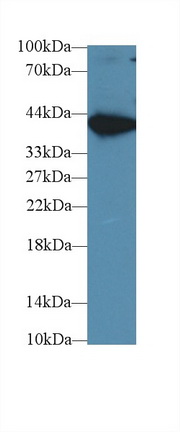 Monoclonal Antibody to Aspartate Aminotransferase (AST)