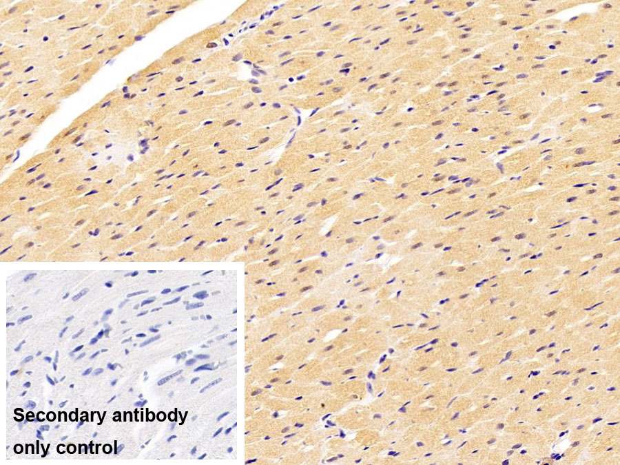 Monoclonal Antibody to Aspartate Aminotransferase (AST)