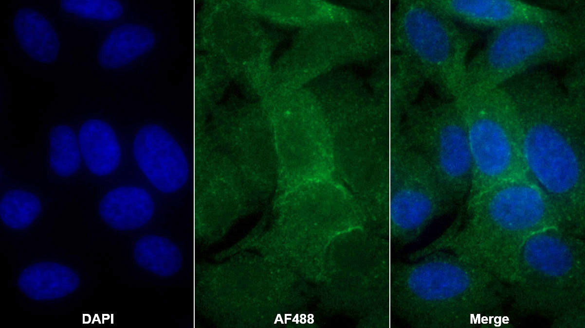 Monoclonal Antibody to Aspartate Aminotransferase (AST)