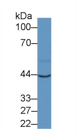 Monoclonal Antibody to Aspartate Aminotransferase (AST)