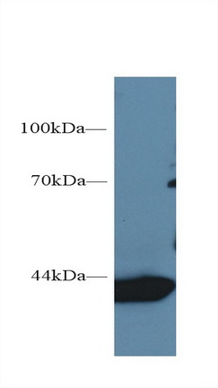 Monoclonal Antibody to Aspartate Aminotransferase (AST)