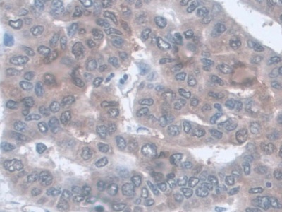 Monoclonal Antibody to Aspartate Aminotransferase (AST)