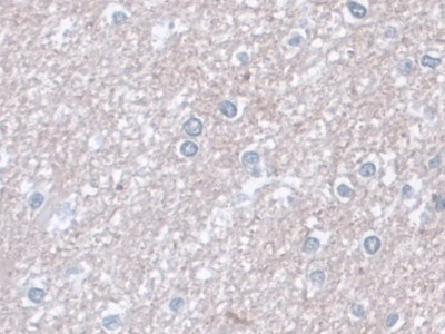 Monoclonal Antibody to Aspartate Aminotransferase (AST)