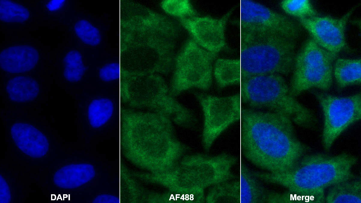 Monoclonal Antibody to Aspartate Aminotransferase (AST)