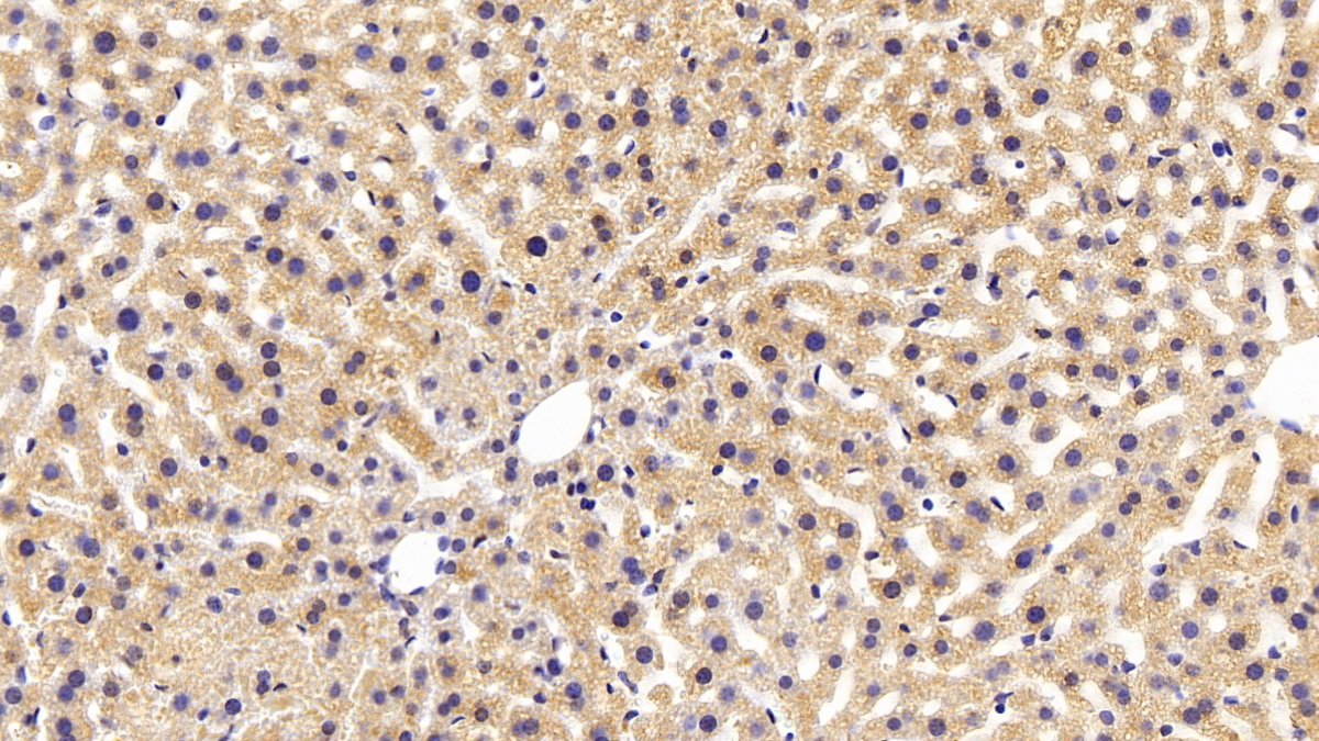 Monoclonal Antibody to Aspartate Aminotransferase (AST)