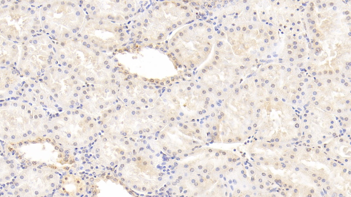 Monoclonal Antibody to Fibrinogen Beta Chain (FGB)