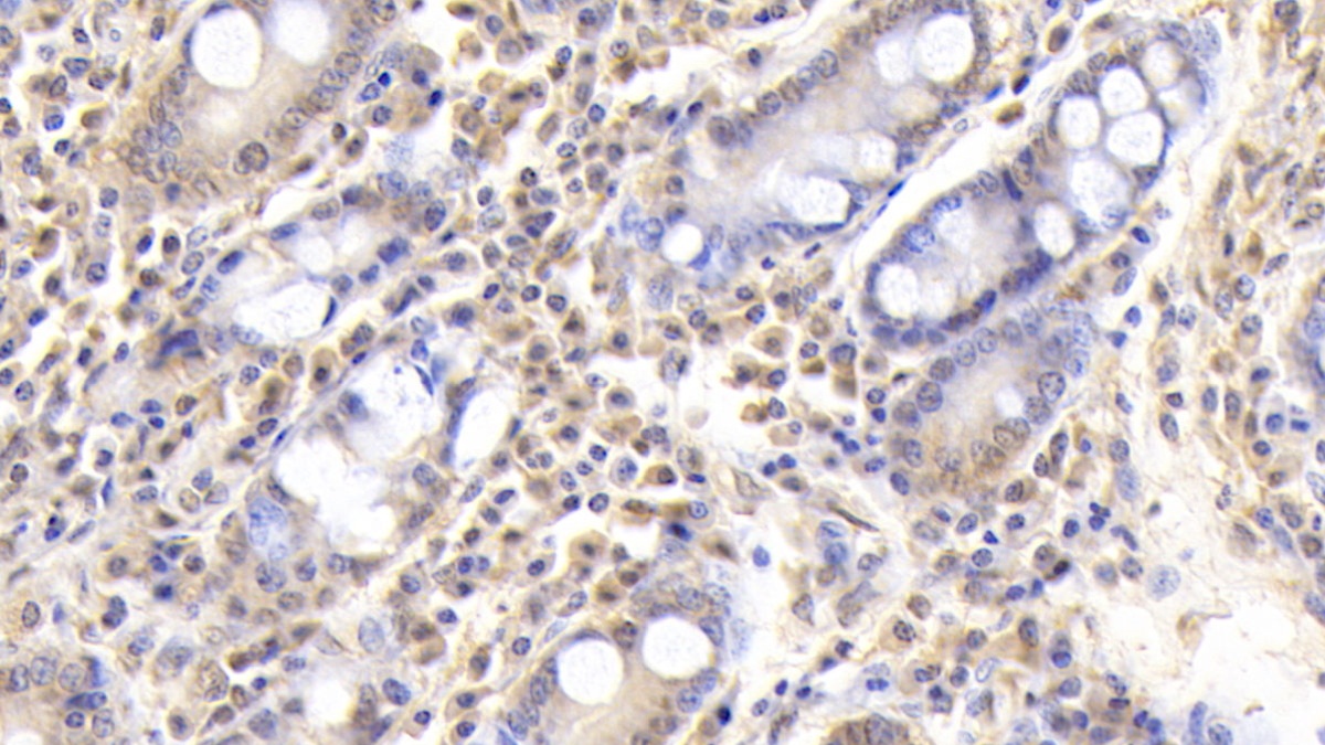 Monoclonal Antibody to Fibrinogen Beta Chain (FGB)