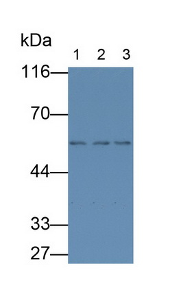 Monoclonal Antibody to Fibrinogen Beta Chain (FGB)