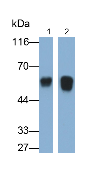 Monoclonal Antibody to Fibrinogen Beta Chain (FGB)