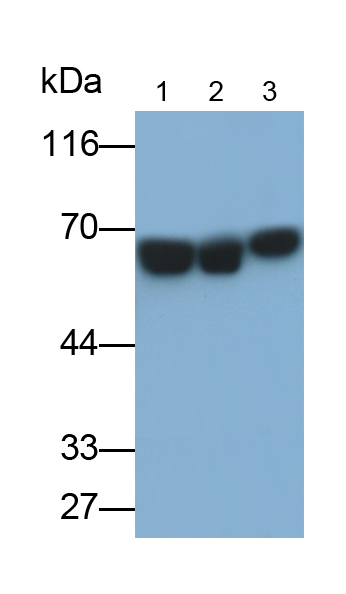 Monoclonal Antibody to Alkaline Phosphatase, Placental (ALPP)