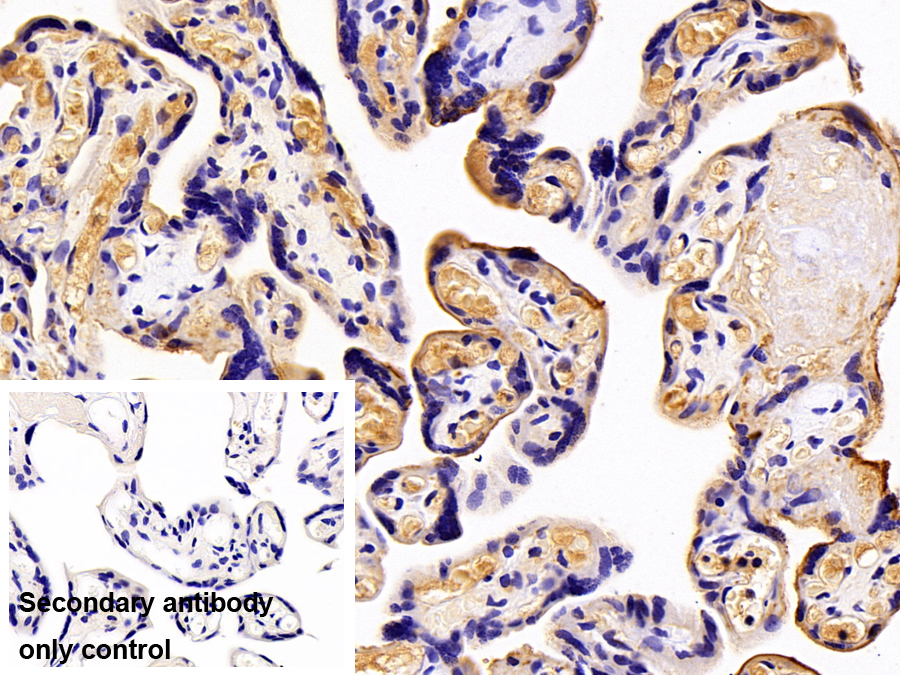 Monoclonal Antibody to Alkaline Phosphatase, Placental (ALPP)