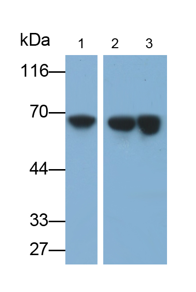 Monoclonal Antibody to Alkaline Phosphatase, Placental (ALPP)