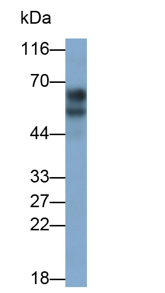 Monoclonal Antibody to Corticosteroid Binding Globulin (CBG)