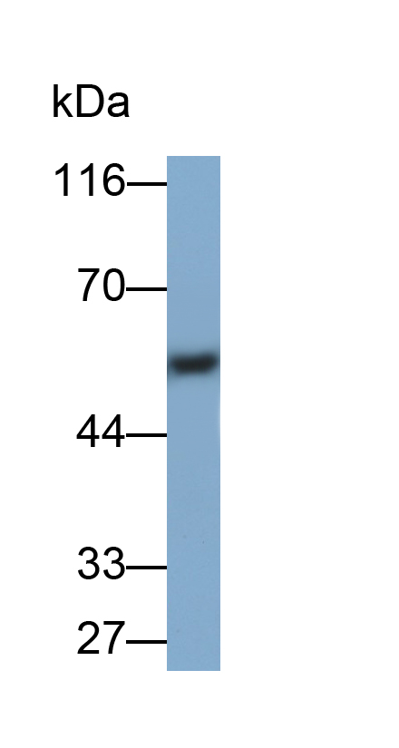 Monoclonal Antibody to Corticosteroid Binding Globulin (CBG)