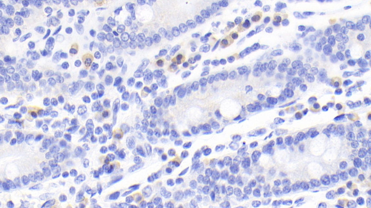 Monoclonal Antibody to Cytotoxic T-Lymphocyte Associated Antigen 4 (CTLA4)