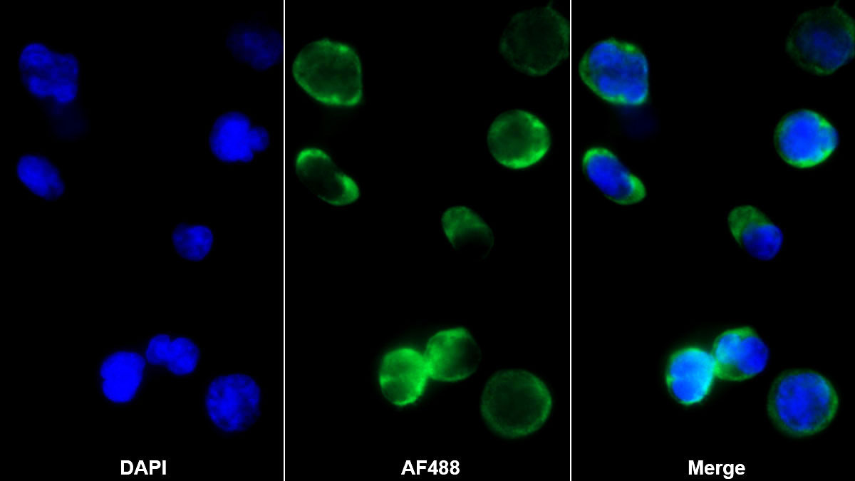 Monoclonal Antibody to Cytotoxic T-Lymphocyte Associated Antigen 4 (CTLA4)