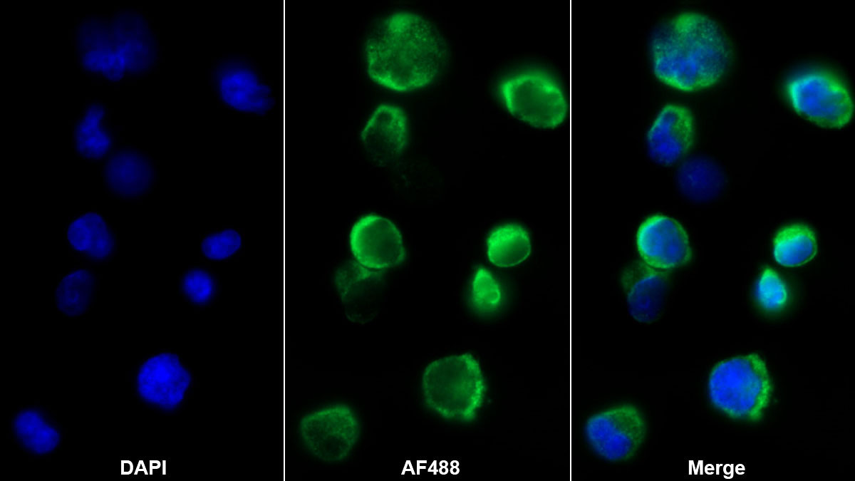 Monoclonal Antibody to Cytotoxic T-Lymphocyte Associated Antigen 4 (CTLA4)