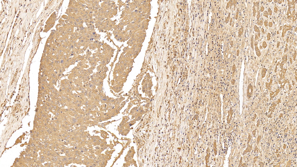 Monoclonal Antibody to Cytokeratin 18 (CK18)