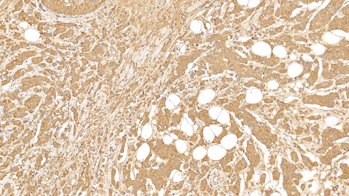 Monoclonal Antibody to Cytokeratin 18 (CK18)