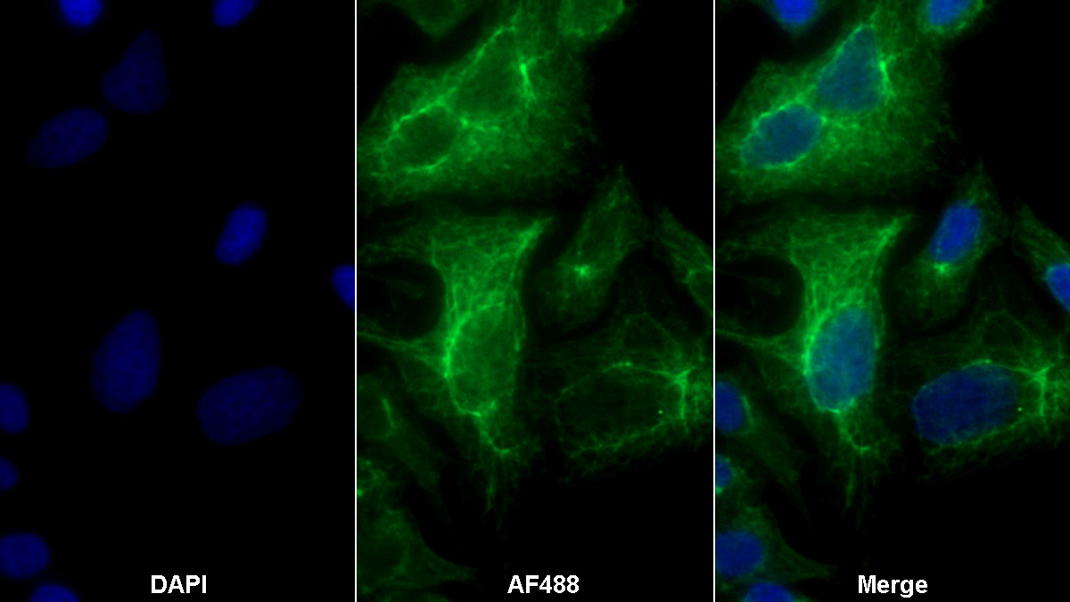 Monoclonal Antibody to Cytokeratin 18 (CK18)