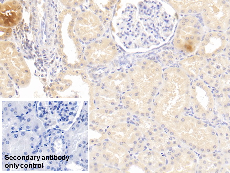 Monoclonal Antibody to Plasminogen (Plg)