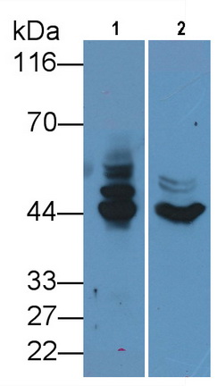 Monoclonal Antibody to Cytokeratin 19 (CK19)