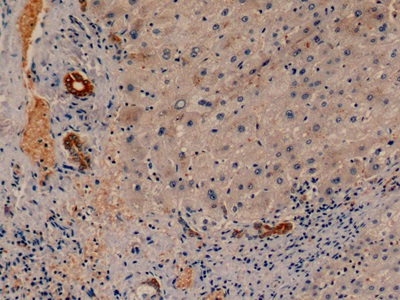 Monoclonal Antibody to Cytokeratin 19 (CK19)