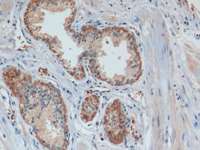 Monoclonal Antibody to Cytokeratin 19 (CK19)