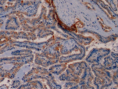 Monoclonal Antibody to Cytokeratin 19 (CK19)