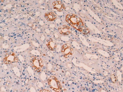 Monoclonal Antibody to Cytokeratin 19 (CK19)